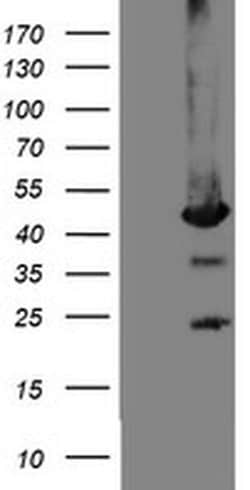 MPI Monoclonal Antibody (OTI4A11), TrueMAB , OriGene 100 &mu;L; Unconjugated:Antibodies,