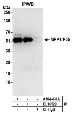 MPP1/P55 Rabbit anti-Human, Polyclonal, Bethyl Laboratories 100 &mu;L | Buy Online | Bethyl Laboratories, Inc | Fisher Scientific