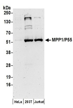 MPP1/P55 Rabbit anti-Human, Polyclonal, Bethyl Laboratories 100 &mu;L | Buy Online | Bethyl Laboratories, Inc | Fisher Scientific