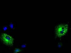 MPP3 Mouse anti-Human, Clone: OTI5E8, lyophilized, TrueMAB 100 &mu;g; Unconjugated:Antibodies,