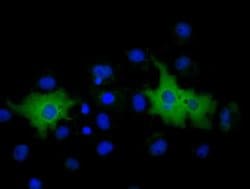 MPP3 Monoclonal Antibody (OTI2A11), TrueMAB , OriGene 100 &mu;L; Unconjugated:Anticuerpos