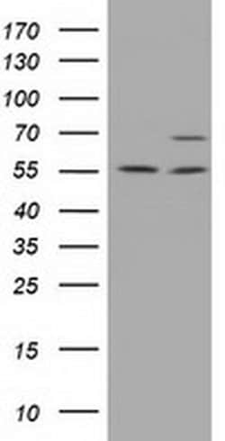 MPP3 Monoclonal Antibody (OTI8B11), TrueMAB , OriGene 30 &mu;L; Unconjugated:Antibodies,