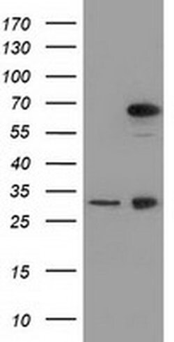 MPP3 Monoclonal Antibody (OTI2A11), TrueMAB , OriGene 100 &mu;L; Unconjugated:Anticuerpos