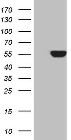 MPP6 Monoclonal Antibody (OTI3H5), TrueMAB , OriGene 30 &mu;L | Buy Online | Origene Technologies | Fisher Scientific