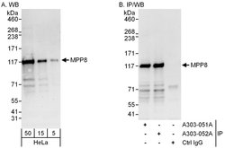 MPP8 Rabbit anti-Human, Polyclonal, Bethyl Laboratories 100 &mu;L; Unconjugated:Antibodies,