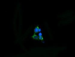 MPZL2 Mouse anti-Human, Clone: OTI2C7, lyophilized, TrueMAB 100 &mu;g;