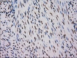 MRI1 Mouse anti-Human, Clone: OTI9H7, liquid, TrueMAB 100 &mu;L; Unconjugated:Antibodies,