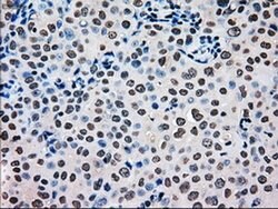 MRI1 Mouse anti-Human, Clone: OTI9H7, liquid, TrueMAB 100 &mu;L; Unconjugated:Antibodies,