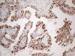 MRPL10 Monoclonal Antibody (OTI2B4), TrueMAB , OriGene 100 &mu;L; Unconjugated:Antibodies,