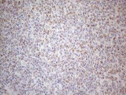 MRPL10 Monoclonal Antibody (OTI2B4), TrueMAB , OriGene 100 &mu;L; Unconjugated:Antibodies,