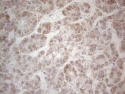 MRPL10 Monoclonal Antibody (OTI2B4), TrueMAB , OriGene 100 &mu;L; Unconjugated:Antibodies,