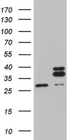 MRPL10 Monoclonal Antibody (OTI2B4), TrueMAB , OriGene 100 &mu;L; Unconjugated:Antibodies,