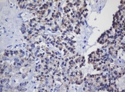 MRPL11 Monoclonal Antibody (OTI1E5), TrueMAB , OriGene 100 &mu;L; Unconjugated:Antibodies,