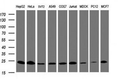 MRPL11 Monoclonal Antibody (OTI1E5), TrueMAB , OriGene 100 &mu;L; Unconjugated:Antibodies,