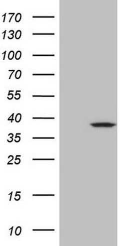 MRPL15 Monoclonal Antibody (OTI7A3), TrueMAB , OriGene 30 &mu;L | Buy Online | Origene Technologies | Fisher Scientific