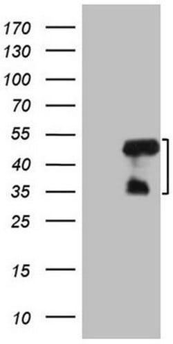 MRPL15 Monoclonal Antibody (OTI2D3), TrueMAB , OriGene 30 &mu;L; Unconjugated:Antibodies,