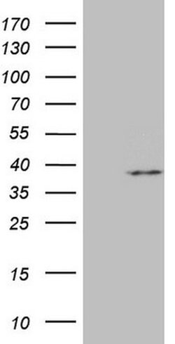 MRPL15 Mouse anti-Human, Clone: OTI10D3, lyophilized, TrueMAB 100 &mu;g | Buy Online | Origene Technologies | Fisher Scientific