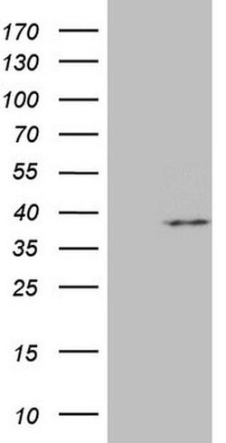 MRPL15 Monoclonal Antibody (OTI10D3), TrueMAB , OriGene:Antibodies:Primary