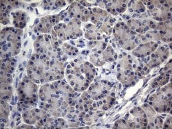 MRPL42 Monoclonal Antibody (OTI1A4), TrueMAB , OriGene 100 &mu;L; Unconjugated:Antibodies,