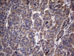 MRPL42 Monoclonal Antibody (OTI1A4), TrueMAB , OriGene 100 &mu;L; Unconjugated:Antibodies,