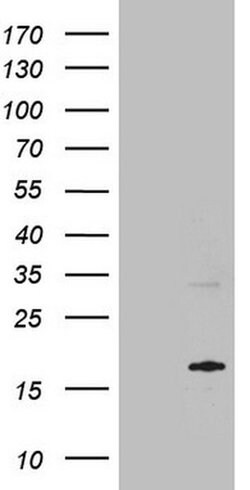 MRPL42 Monoclonal Antibody (OTI1A4), TrueMAB , OriGene 100 &mu;L; Unconjugated:Antibodies,