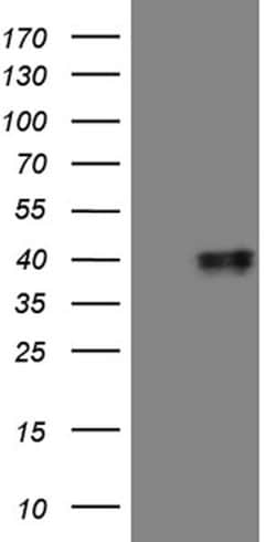 MRPL44 Mouse anti-Human, Clone: OTI2A8, lyophilized, TrueMAB 100 &mu;g;