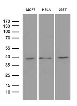 MRPL44 Mouse anti-Human, Clone: OTI2A8, lyophilized, TrueMAB 100 &mu;g;