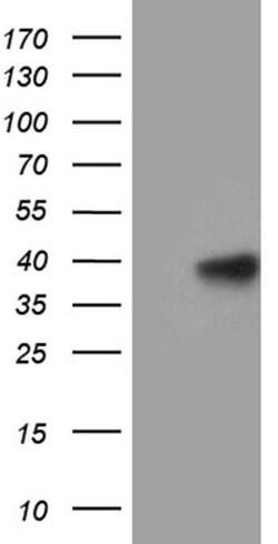 MRPL44 Monoclonal Antibody (OTI1A1), TrueMAB , OriGene 100 &mu;L; Unconjugated:Antibodies,