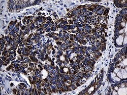 MRPL48 Monoclonal Antibody (OTI3C5), TrueMAB , OriGene:Antibodies:Primary