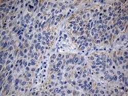 MRPL48 Monoclonal Antibody (OTI8E1), TrueMAB , OriGene 100 &mu;L; Unconjugated:Antibodies,