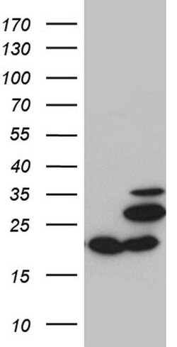 MRPL48 Monoclonal Antibody (OTI3C5), TrueMAB , OriGene 100 &mu;L; Unconjugated:Antibodies,