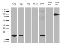 MRPL48 Monoclonal Antibody (OTI8E1), TrueMAB , OriGene:Antibodies:Primary