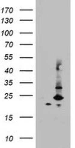 MRPS11 Mouse anti-Human, Clone: OTI2E6, lyophilized, TrueMAB 100 &mu;g;