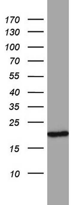MRPS11 Monoclonal Antibody (OTI3B1), TrueMAB , OriGene:Antibodies:Primary