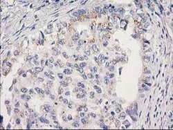 MRPS2 Monoclonal Antibody (OTI4D6), TrueMAB , OriGene 100 &mu;L; Unconjugated:Antibodies,