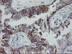 MRPS27 Mouse anti-Human, Clone: OTI6E5, lyophilized, TrueMAB 100 &mu;g;