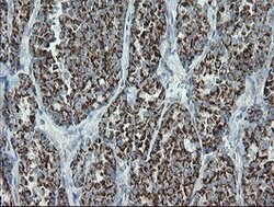 MRPS27 Mouse anti-Human, Clone: OTI6E5, lyophilized, TrueMAB 100 &mu;g;