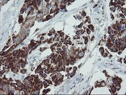 MRPS27 Mouse anti-Human, Clone: OTI6E5, lyophilized, TrueMAB 100 &mu;g;