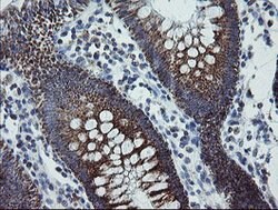 MRPS27 Mouse anti-Human, Clone: OTI6E5, lyophilized, TrueMAB 100 &mu;g;