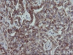 MRPS27 Mouse anti-Human, Clone: OTI6E5, lyophilized, TrueMAB 100 &mu;g;