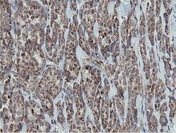 MRPS27 Monoclonal Antibody (OTI3A8), TrueMAB , OriGene 100 &mu;L; Unconjugated:Antibodies,