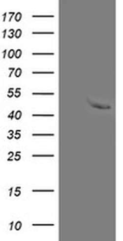 MRPS27 Monoclonal Antibody (OTI1A5), TrueMAB , OriGene 100 &mu;L; Unconjugated:Antibodies,