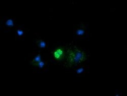 MRPS34 Mouse anti-Human, Clone: OTI4B9, lyophilized, TrueMAB 100 &mu;g;