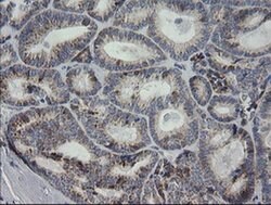 MRPS34 Monoclonal Antibody (OTI4C9), TrueMAB , OriGene 100 &mu;L; Unconjugated:Antibodies,