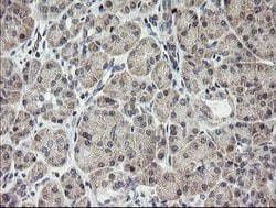 MRPS34 Mouse anti-Human, Clone: OTI4B9, lyophilized, TrueMAB 100 &mu;g;