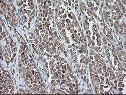 MRPS34 Mouse anti-Human, Clone: OTI4B9, lyophilized, TrueMAB 100 &mu;g;