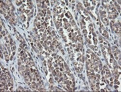 MRPS34 Monoclonal Antibody (OTI4B9), TrueMAB , OriGene 30 &mu;L | Buy Online | Origene Technologies | Fisher Scientific
