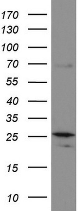 MRPS7 Mouse anti-Human, Clone: UMAB156, liquid, UltraMAB 100 &mu;L; Unconjugated:Antibodies,