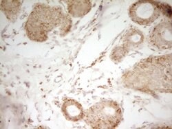 MRRF Monoclonal Antibody (OTI1D5), TrueMAB , OriGene 100 &mu;L; Unconjugated:Antibodies,