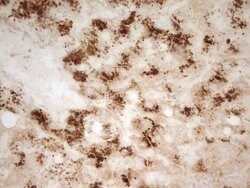 MRRF Monoclonal Antibody (OTI1D5), TrueMAB , OriGene 100 &mu;L; Unconjugated:Antibodies,